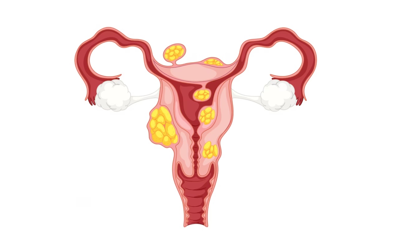 Drawing the Uterus