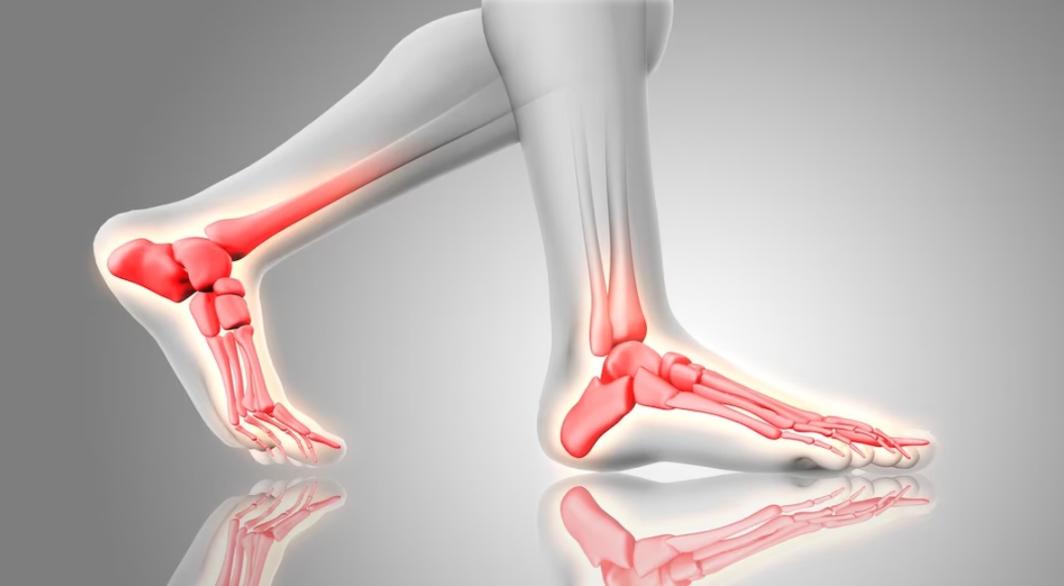 Foot and Ankle