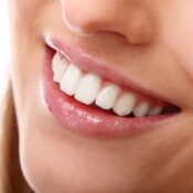 Hollywood Smile