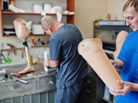 Joint Prosthesis Treatment