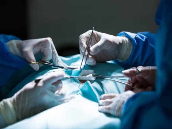 Laparoscopic Surgery & Turkey