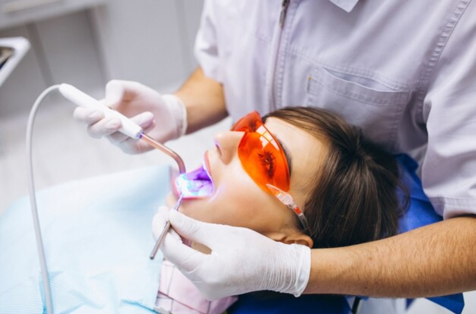 Laser Teeth Whitening